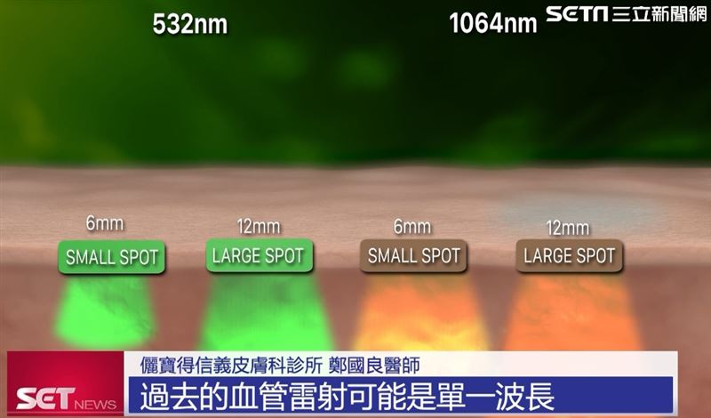 微光庇護計畫 號召醫師助顏面胎記孩童