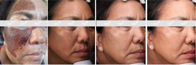 Tratamientos de belleza inteligentes: ¿Cuáles son los lugares más seguros para acudir hoy en día? - Imagen 1.